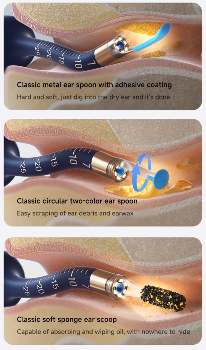 Bebird Earsight Plus R37R eyrnahreinsisett